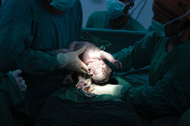 Entidades médicas defendem que a equipe tem que ter um pediatra, normalmente um neonatologista, para receber o bebê.