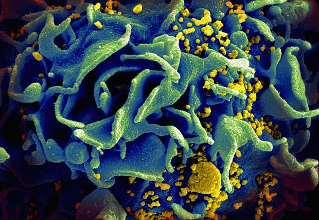 Imagem de microscópio mostra superfície de célula do sistema imune infectada por HIV (Foto: NIAID/NIH).